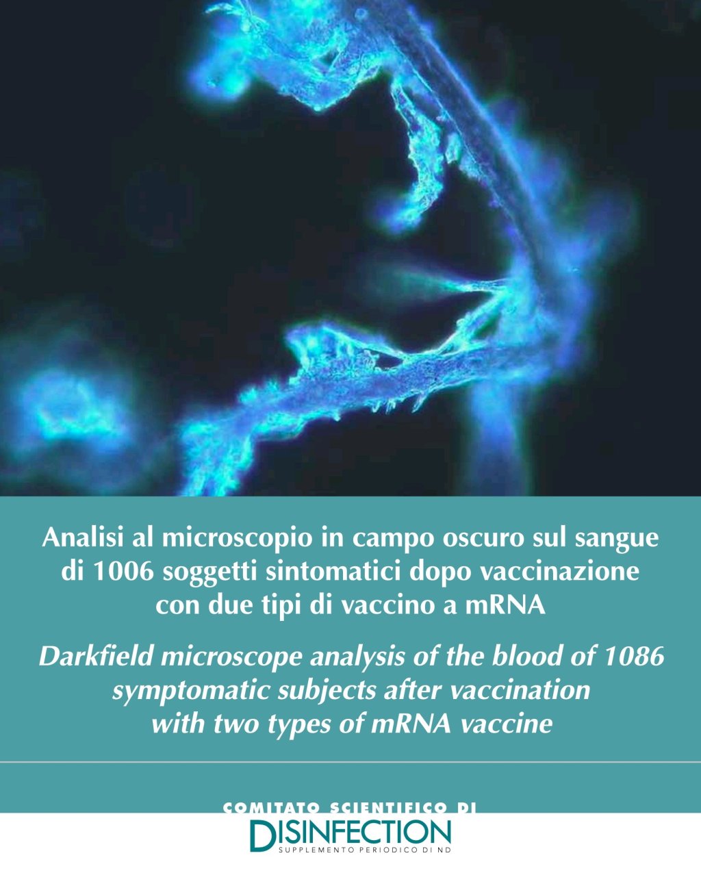 🆘️💣Analisi al microscopio in campo oscuro sul sangue di 1006 soggetti sintomatici dopo vaccinazione con due tipi di vaccino a&nbsp;mRNA.